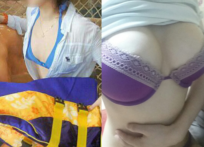 크기변환_가슴수술.jpg