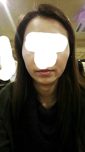 수술전_모.jpg