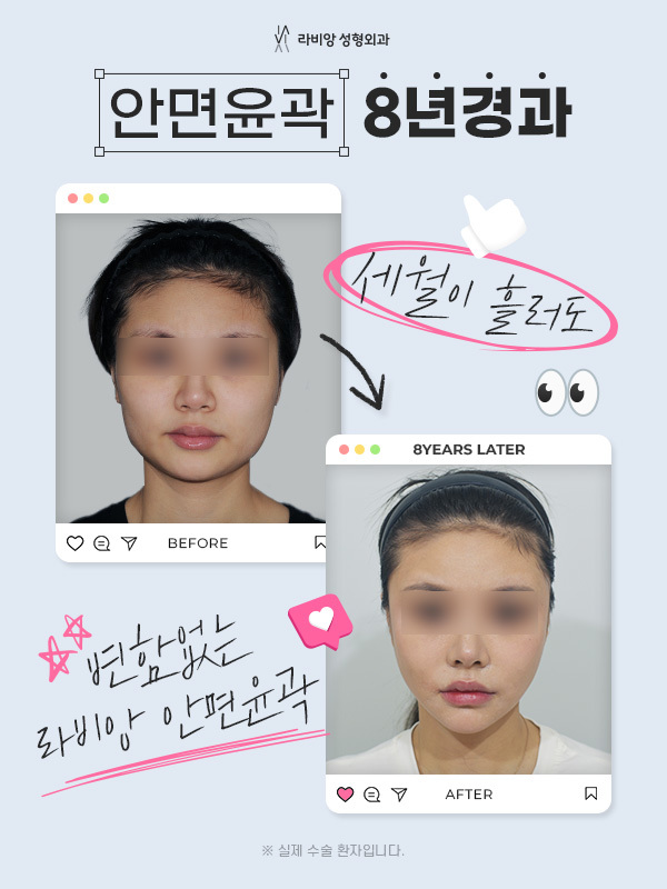 윤곽 8년 경과